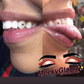Teeth Whitening & Tooth Gems Training (W/Machine)