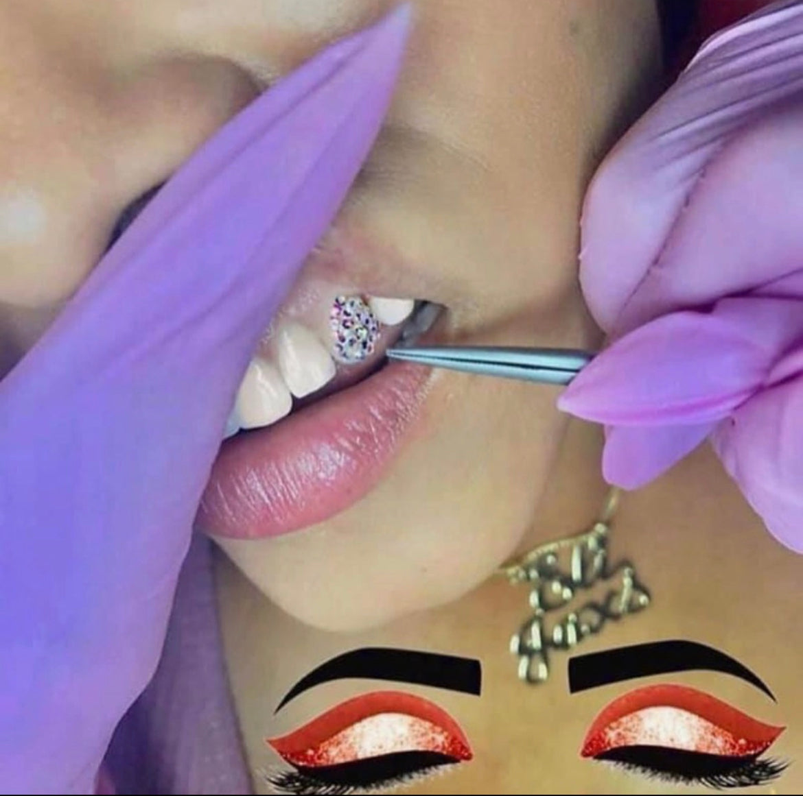 Tooth Gem Training (W/Machine)