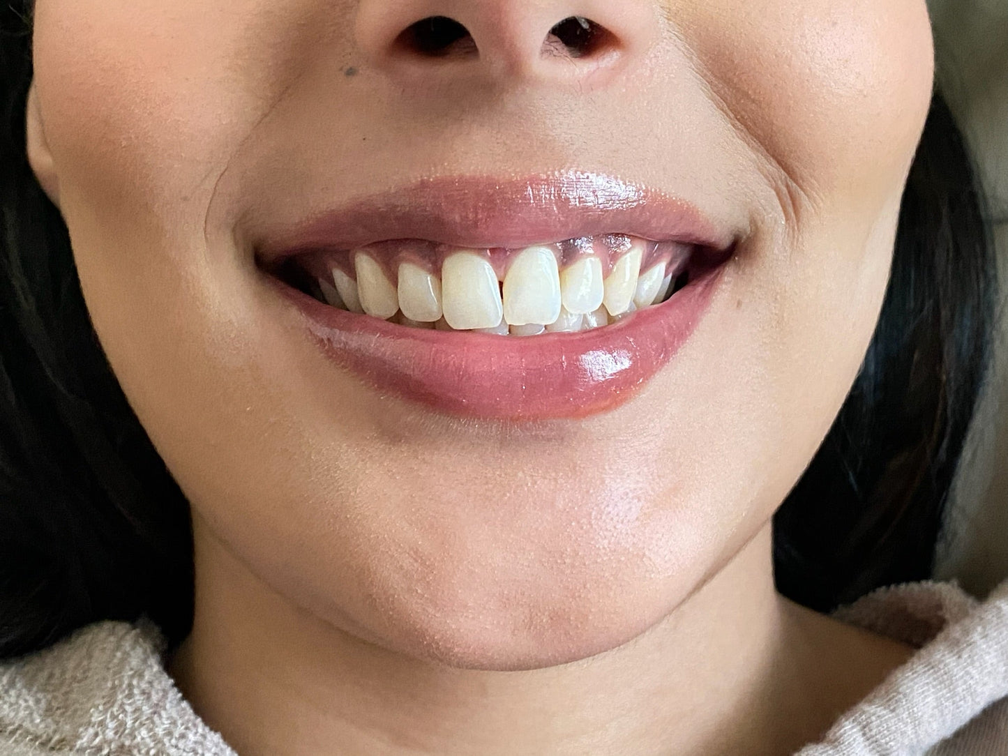 Teeth Whitening & Tooth Gems Training (W/Machine)