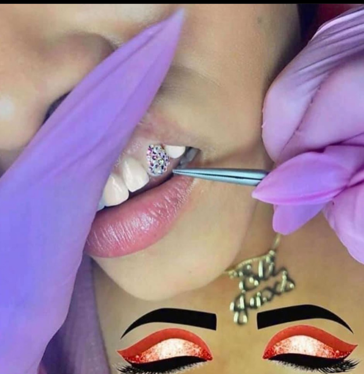 Teeth Whitening & Tooth Gems Training (W/Machine)